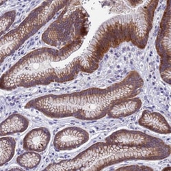 DCAF12L2 Antibody, Novus Biologicals:Antibodies:Primary Antibodies