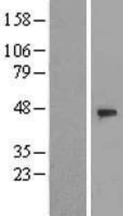 Novus Biologicals&trade;&nbsp;DCAF4 Overexpression Lysate