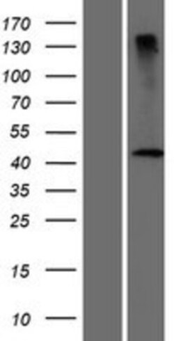 Novus Biologicals™ DCAF4L2 Overexpression Lysate