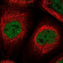 DCAF8L1 Antibody, Novus Biologicals:Antibodies:Primary Antibodies