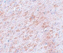 DCAMKL2 Antibody - BSA Free, Novus Biologicals 0.1mg; Unlabeled:Antibodies,