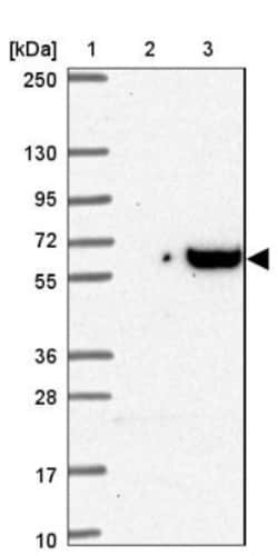 DCBLD1 Antibody, Novus Biologicals 0.1mL; Unlabeled:Antibodies, Polyclonal