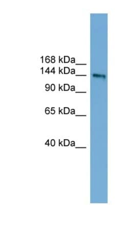DCC Antibody, Novus Biologicals:Antibodies:Primary Antibodies