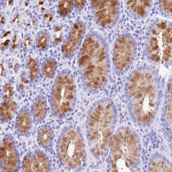 DCDC2B Antibody, Novus Biologicals:Antibodies:Primary Antibodies