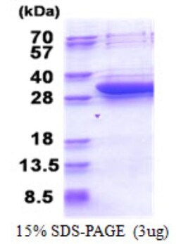 Novus Biologicals&trade;&nbsp;Recombinant Human DCI His Protein