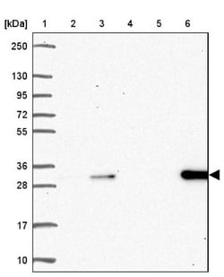 DCK Antibody, Novus Biologicals:Antibodies:Primary Antibodies
