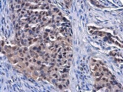 DCK Antibody (10412), Novus Biologicals 0.1mL; Unlabeled:Antibodies, Monoclonal