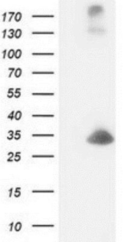 DCK Antibody (OTI3F5), Novus Biologicals 0.1 mL | Buy Online | Novus Biologicals | Fisher Scientific