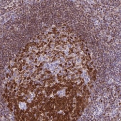 DCK Antibody, Novus Biologicals:Antibodies:Primary Antibodies