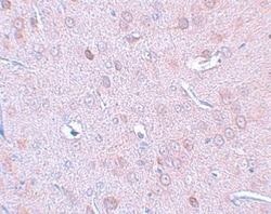 DCLK1 Antibody - BSA Free, Novus Biologicals 0.1mg; Unlabeled:Antibodies,