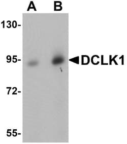 DCLK1 Antibody - BSA Free, Novus Biologicals 0.1mg; Unlabeled:Antibodies,