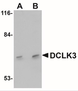 DCLK3 Antibody - BSA Free, Novus Biologicals 0.025 mg, Unconjugated:Antibodies,