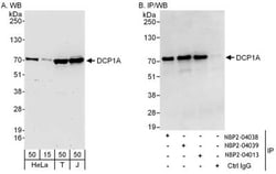 Dcp1a Antibody, Novus Biologicals 0.1mg; Unlabeled:Antibodies, Polyclonal