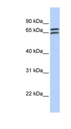 DCP1B Antibody, Novus Biologicals:Antibodies:Primary Antibodies