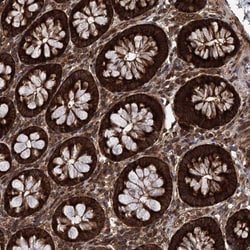 DCP1B Antibody, Novus Biologicals:Antibodies:Primary Antibodies