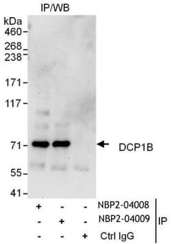 DCP1B Antibody, Novus Biologicals 0.1mg; Unlabeled:Antibodies, Polyclonal