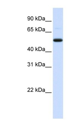 DCP2 Antibody, Novus Biologicals:Antibodies:Primary Antibodies