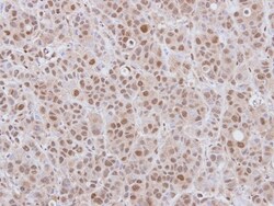 DCPS Antibody, Novus Biologicals 0.1mL; Unlabeled:Antibodies, Polyclonal