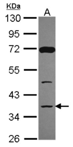 DCPS Antibody, Novus Biologicals 0.1mL; Unlabeled:Antibodies, Polyclonal