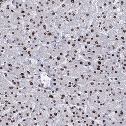 DCPS Antibody, Novus Biologicals 0.1mL; Unlabeled:Antibodies, Polyclonal