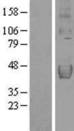 Novus Biologicals&trade;&nbsp;TRAILR4/TNFRSF10D/DcR2 Overexpression Lysate