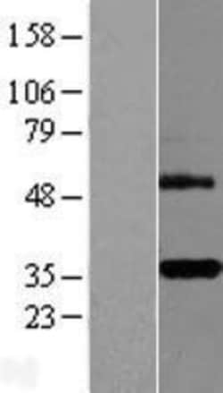Novus Biologicals&trade;&nbsp;DcR3/TNFRSF6B Overexpression Lysate