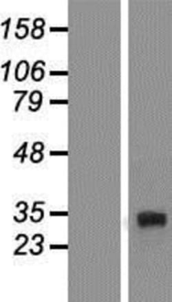 Novus Biologicals&trade;&nbsp;DcR3/TNFRSF6B Overexpression Lysate