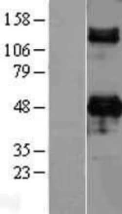 Novus Biologicals&trade;&nbsp;DC-SIGN/CD209 Overexpression Lysate