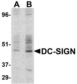 DC-SIGN/CD209 Antibody - BSA Free, Novus Biologicals 0.025 mg | Buy Online | Novus Biologicals | Fisher Scientific