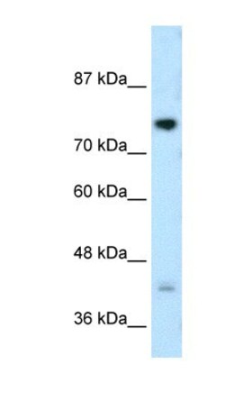 DCST1 Antibody, Novus Biologicals 0.05mg; Unlabeled:Antibodies, Polyclonal
