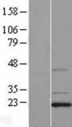 Novus Biologicals™ DCTN3 Overexpression Lysate