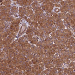 DCTN3 Antibody, Novus Biologicals 25 &mu;L, Unconjugated:Antibodies, Polyclonal