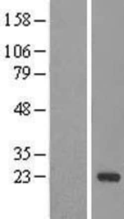 Novus Biologicals&trade;&nbsp;DCTN5 Overexpression Lysate