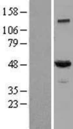 Novus Biologicals&trade;&nbsp;Dynactin Subunit 2/DCTN2/DCTN-50 Overexpression Lysate
