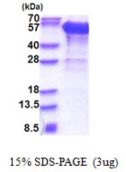 Novus Biologicals&trade;&nbsp;Recombinant Human Dynactin Subunit 2/DCTN2/DCTN-50 His Protein