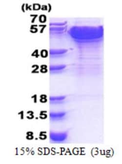 Novus Biologicals Recombinant Human Dynactin Subunit 2/DCTN2/DCTN-50 His Protein 0.1 mg | Buy Online | Novus Biologicals&trade; | Fisher Scientific