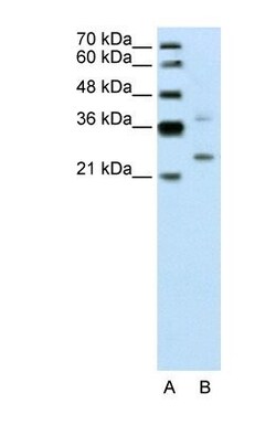 DCUN1D1 Antibody, Novus Biologicals 0.05mg; Unlabeled:Antibodies, Polyclonal