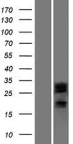 Novus Biologicals™ DCUN1D2 Overexpression Lysate