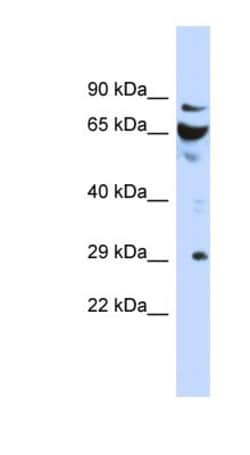 DCUN1D3 Antibody, Novus Biologicals 100&mu;L; Unlabeled:Antibodies, Polyclonal
