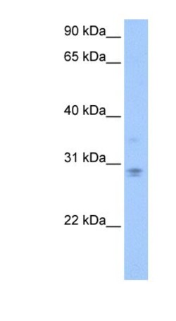 DCUN1D3 Antibody, Novus Biologicals:Antibodies:Primary Antibodies