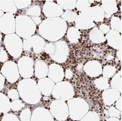 DCUN1D5 Antibody, Novus Biologicals 0.1mL; Unlabeled:Antibodies, Polyclonal