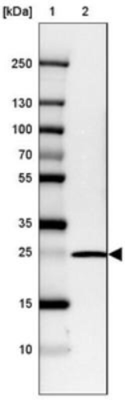 DCUN1D5 Antibody, Novus Biologicals 0.1mL; Unlabeled:Antibodies, Polyclonal
