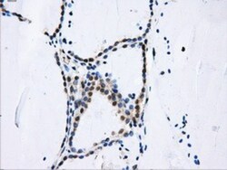 DCXR Antibody (OTI7D11), Novus Biologicals 0.1mL; Unlabeled:Antibodies,