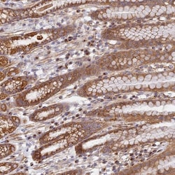 DDA1 Antibody, Novus Biologicals:Antibodies:Primary Antibodies