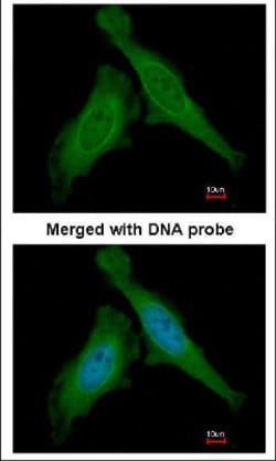 DDB1 Antibody, Novus Biologicals 0.1mL; Unlabeled:Antibodies, Polyclonal