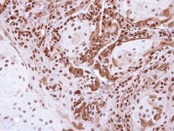 DDB1 Antibody, Novus Biologicals 0.1mL; Unlabeled:Antibodies, Polyclonal