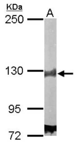 DDB1 Antibody, Novus Biologicals 0.1mL; Unlabeled:Antibodies, Polyclonal
