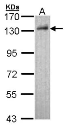 DDB1 Antibody, Novus Biologicals 0.1mL; Unlabeled:Antibodies, Polyclonal