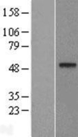 Novus Biologicals&trade;&nbsp;XPE/DDB2 Overexpression Lysate