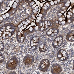 DDHD2 Antibody, Novus Biologicals:Antibodies:Primary Antibodies